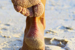 τρέξιμο στην άμμο