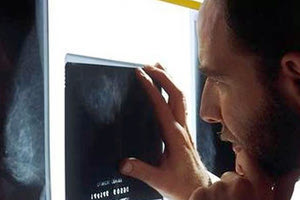 όγκοι μαστού