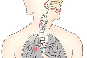 αναπνευστικό σύστημα