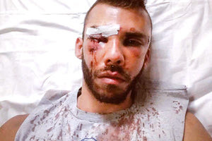 O αναίτιος και άγριος ξυλοδαρμός του 30χρονου στην παλιά πόλη του Ρεθύμνου