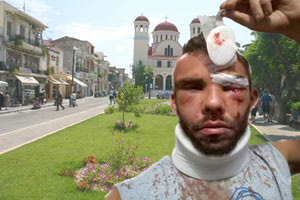 Ο άτυχος 30χρονος που έπεσε θύμα άγριου ξυλοδαρμού στην παλιά πόλη του Ρεθύμνου