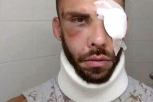 ξυλοκόπησαν νεαρο Έλληνα στις 15 Οκτωβρίου χωρίς λόγο στο κέντρο του Ρεθύμνου.