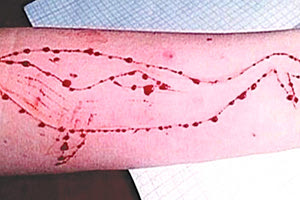 “μπλε φάλαινα”