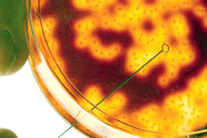 Μηνιγγίτιδα