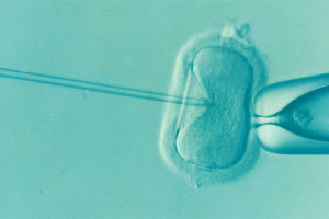 προβλήματα γονιμότητας