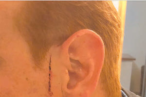 Γιος γνωστού επιχειρηματία καταγγέλλει αστυνομική βία