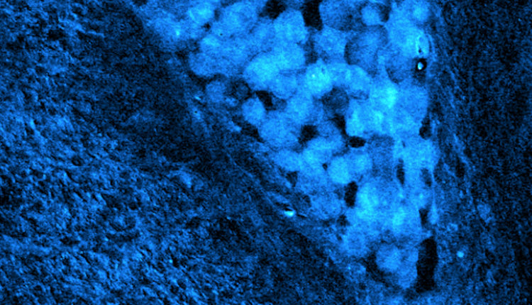 μορφές καρκίνου