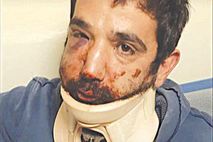 ξυλοδαρμός ντελιβερά από τον πρώην εργοδότη του