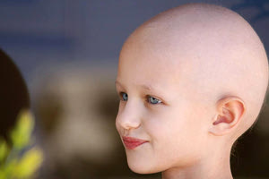 Νέα μέθοδος εμποδίζει την απώλεια μαλλιών σε ασθενείς με καρκίνο κατά τη διάρκεια χημειοθεραπείας