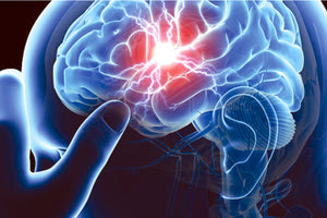 εγκεφαλικά