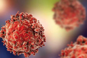 καρκινικά κύτταρα