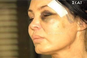 H Μαντώ Τζαβάρα οποία κατέθεσε μήνυση για ξυλοδαρμό εις βάρος του συντρόφου της και πρώην μπασκετμπολίστα Μανώλη Παπαμακάριου