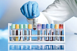 εξετάσεις αίματος