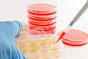 βλαστοκύτταρα