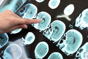 απεικονιστικές εξετάσεις (αξονικές, μαγνητικές, μαστογραφίες)