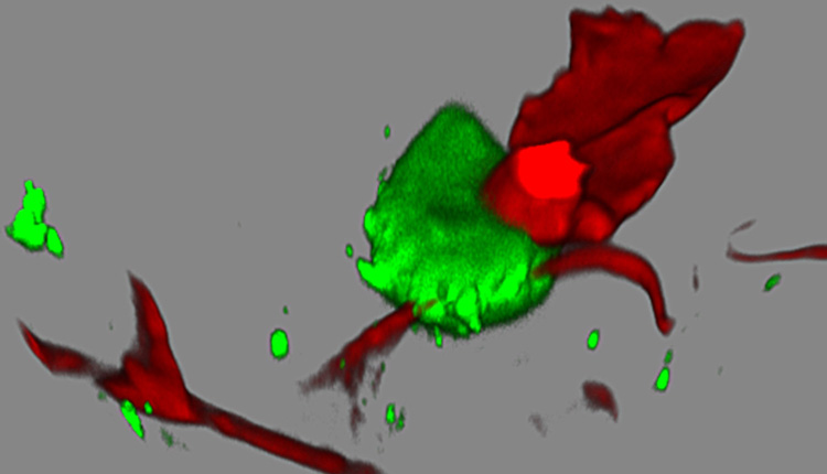Απεικόνιση διηθητικής λοίμωξης Drosophila melanogaster (μύγα ξυδιού) από μύκητες Mucorales.