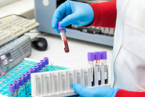 ερευνητές κατά του καρκίνου