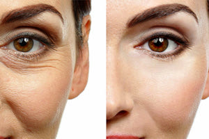 ΜΗ ΕΠΕΜΒΑΤΙΚΗ ΒΛΕΦΑΡΟΠΛΑΣΤΙΚΗ PLEXR