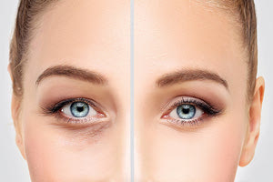 Plexr μη επεμβατική ιατρική δερματολογία στην επιδερμίδα του προσώπου