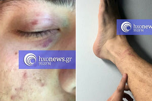 Μία σοκαριστική καταγγελία για την προσαγωγή, τον άγριο ξυλοδαρμό και βασανισμό του από αστυνομικούς του Α.Τ. Ιεράπετρας έκανε 25χρονος, με αφορμή τον έλεγχό του για την απαγόρευση κυκλοφορίας.