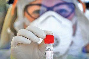 το αντιιικό σκεύασμα ρεμδεσιβίρη είχε «θετικά» αποτελέσματα όταν χορηγήθηκε σε ασθενείς με Covid-19