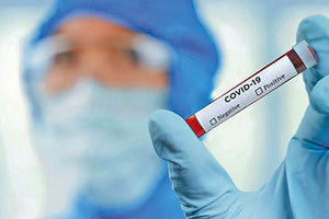 Μελέτη για τα επίπεδα ανοσίας του πληθυσμού στον κοροναϊό