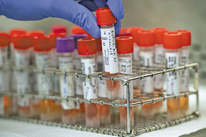 έρευνες για την ανάπτυξη εμβολίου και θεραπειών κατά του νέου κοροναϊού