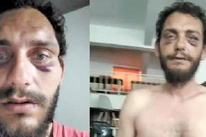 Ο 38χρονος που κατήγγειλε ότι έπεσε θύμα αστυνομικής βίας από δύο δικυκλιστές αστυνομικούς της Ομάδας ΔΙΑΣ στον κεντρικό δρόμο της Αμμουδάρας