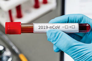 έλεγχοι δειγμάτων για κοροναϊό