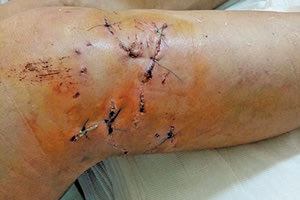 Έτσι γλίτωσα από του σκύλου τα δόντια