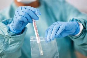 Τεστ αντισωμάτων