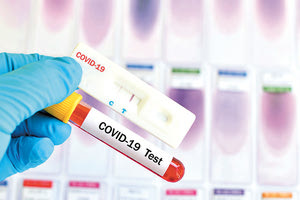 διεξαγωγή του τεστ κοροναϊού