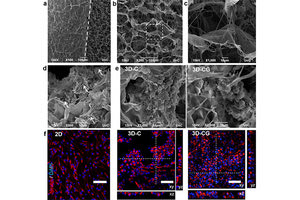 Μία νέα γενιά νευροεμφυτευμάτων αναγέννησης του νευρικού ιστού από το ΙΤΕ
