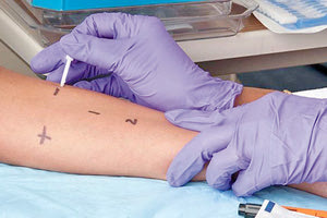 αλλεργικό σοκ