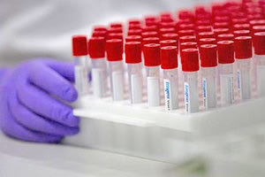 Pfizer - κοροναϊός: Ξεκίνησε την παραγωγή του εμβολίου, υπό αναμονή για έγκριση