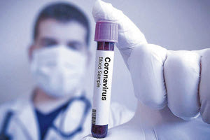 νόσος Covid-19 απ' τον κοροναϊό SARS-CoV-2