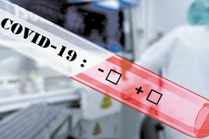 ο δείκτης θετικότητας των τεστ Covid