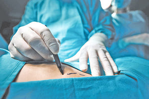 χειρουργική επέμβαση