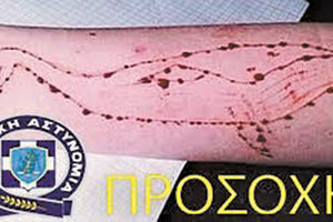 “Μπλε Φάλαινα”