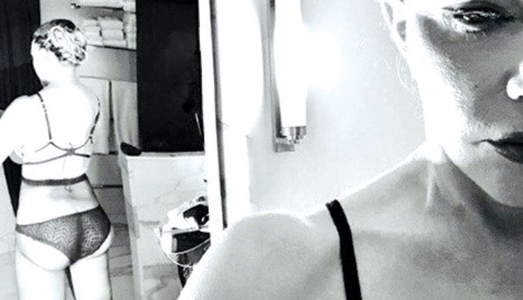 Μαντόνα επέμβαση