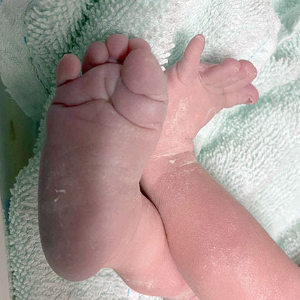 νεογέννητο