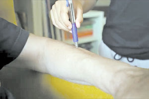 εμβολιασμός