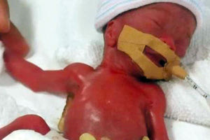 -Γεννήθηκε με το βάρος ενός… μήλου