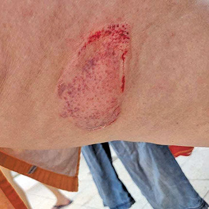 ΔΑΓΚΩΜΑ ΧΕΛΩΝΑΣ