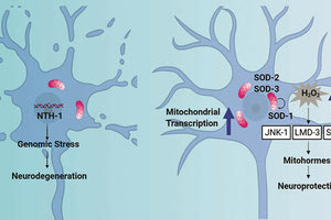ΠΑΡΚΙΝΣΟΝ ΙΤΕ