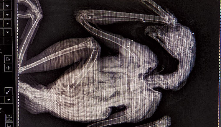 Ακτινογραφία με εμφανή τα σκάγια στο σώμα του νεαρού σπιζαετού