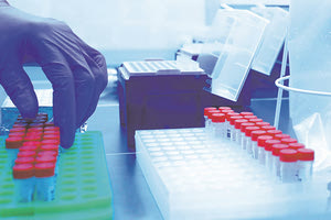 ΕΡΓΑΣΤΗΡΙΟ ΤΟΞΙΚΟΛΟΓΙΑΣ: Τι δείχνει ο έλεγχος αντισωμάτων σε 517 υγειονομικούς της Κρήτης