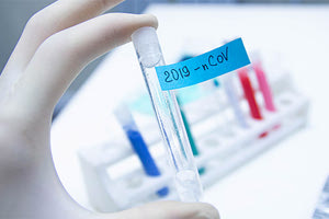 τεστ κορονοϊού Covid-19