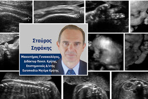 Σταύρος Σηφάκης: Μαιευτήρας Γυναικολόγος, Διδάκτωρ Πανεπ. Κρήτης, Επιστημονικός Δ/ντής Euromedica Μητέρα Κρήτης