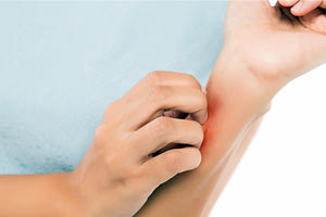 Το δερματικό σύμπτωμα της ΟΜΙΚΡΟΝ